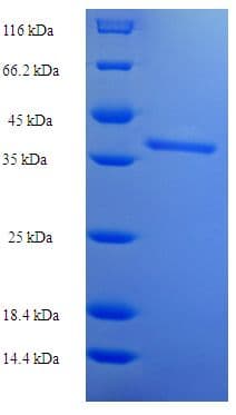 Human SPN / CD43 Protein (Recombinant His-SUMO)