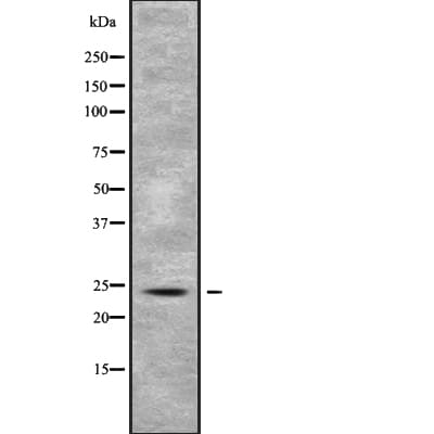 RAB5B Antibody