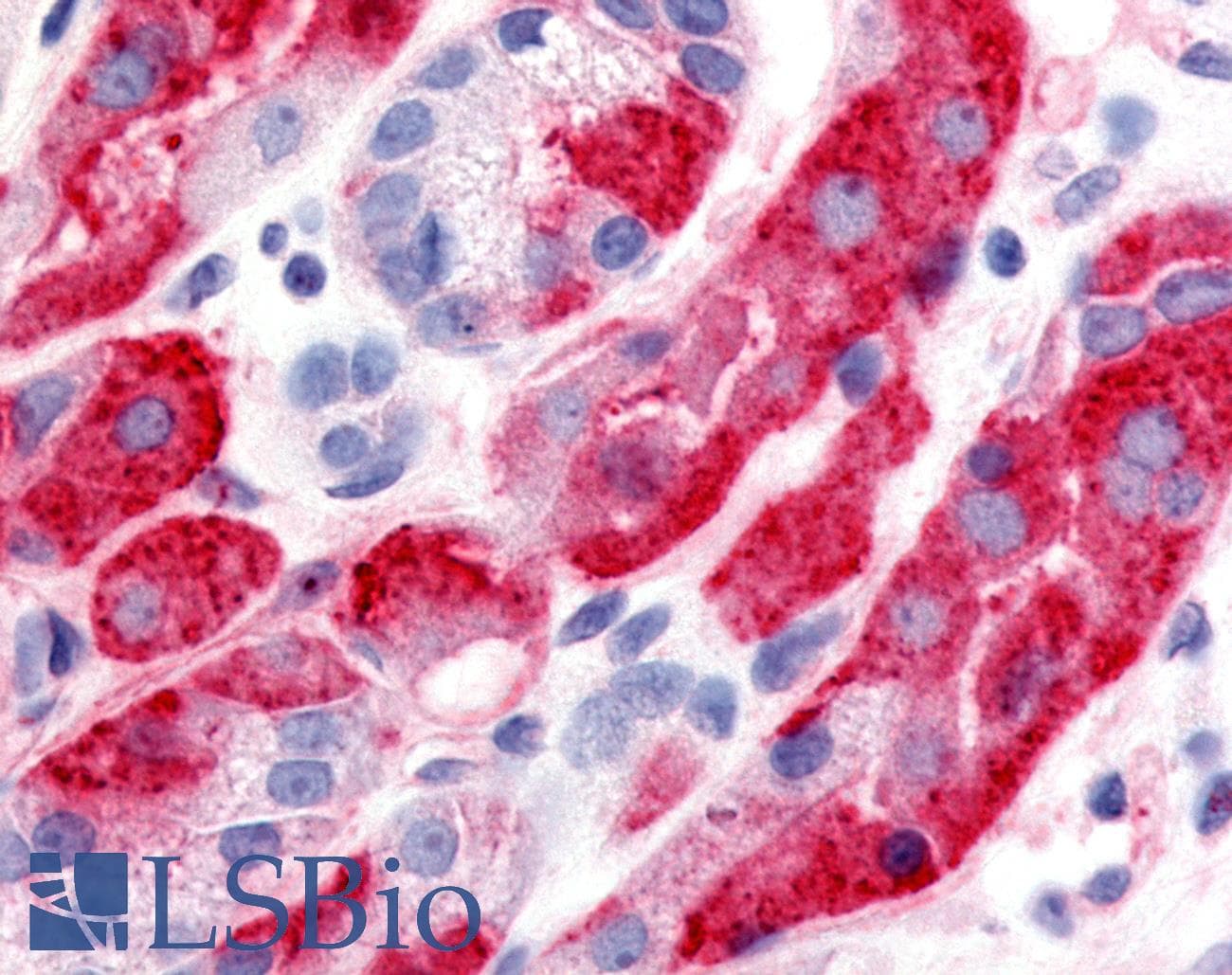 IHC-plus™ Polyclonal Rabbit anti-Human DPP2 / DPP7 Antibody (Extracellular Domain)