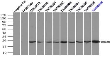 CRYAB / Alpha B Crystallin Antibody (clone OTI6G5)
