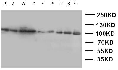 Polyclonal Rabbit anti-Human VCP Antibody (aa749-766, IHC, WB)