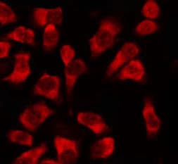 KRT7 / CK7 / Cytokeratin 7 Antibody