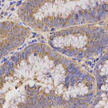 Polyclonal Rabbit anti-Human TNFRSF1B / TNFR2 Antibody (IHC, IF, WB)