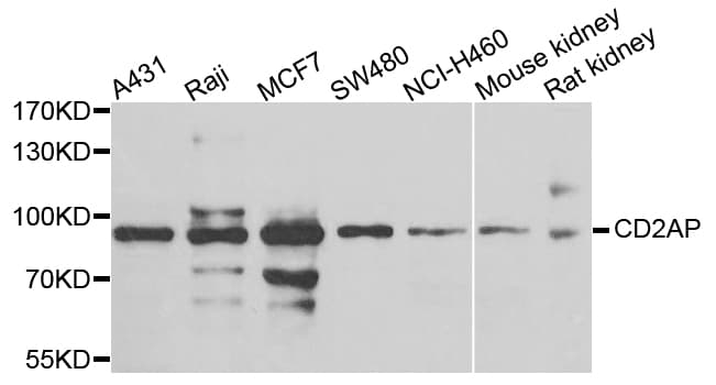 CD2AP Antibody (AP)