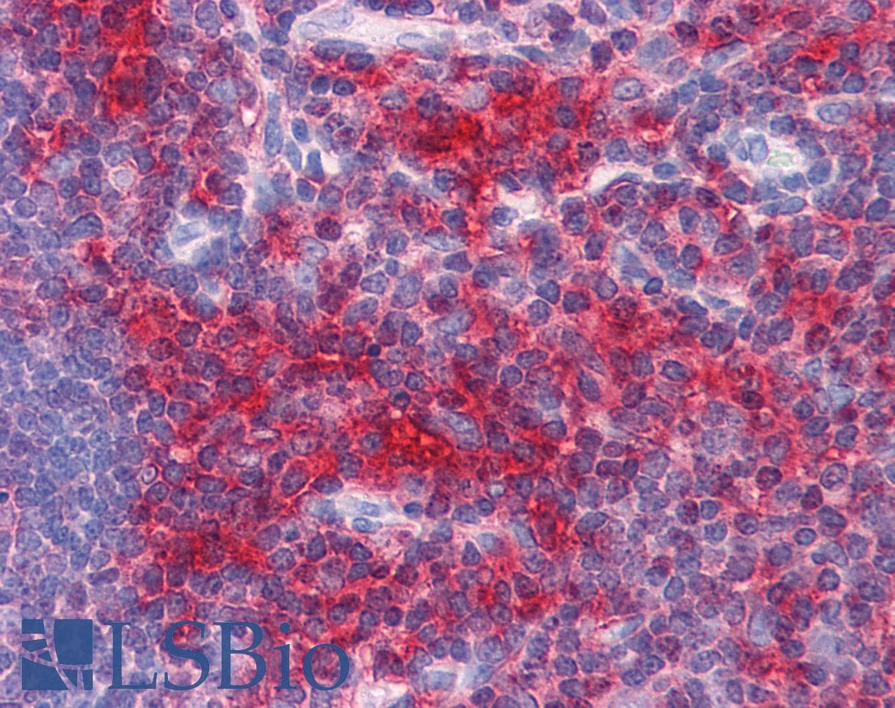 IHC-plus™ ADAMTS17 Antibody (clone 3B7)