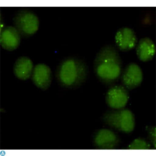 TFB1 / GTF2H1 Antibody