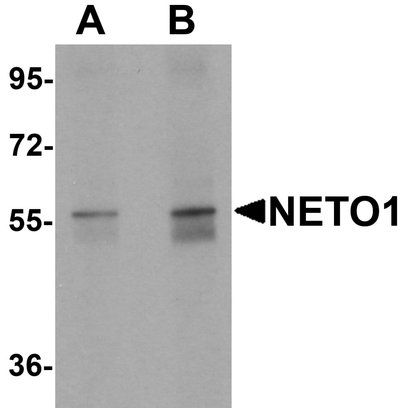 Polyclonal Rabbit anti-Human NETO1 Antibody (IHC, IF, WB)