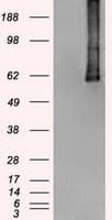 Monoclonal Mouse anti-Human PLK1 / PLK-1 Antibody (clone OTI3F12, IHC, WB)