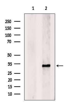 Polyclonal Rabbit anti-Human ATP6E / ATP6V1E1 Antibody (WB)
