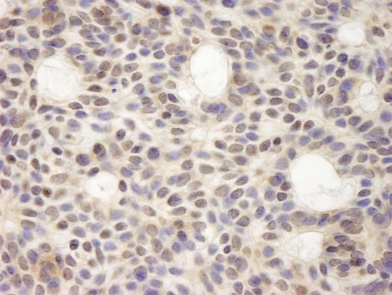 HURP / DLGAP5 Antibody (aa200-250)