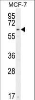 CTDSPL2 Antibody (aa52-80)