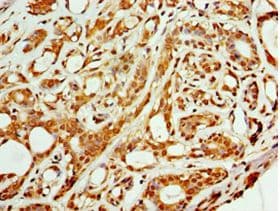 Polyclonal Rabbit anti-Human ARFGAP3 Antibody (aa217-516, IHC, WB)