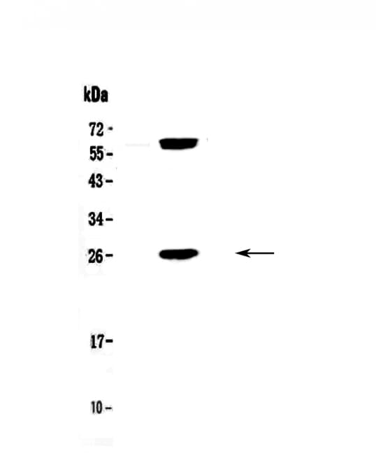 Polyclonal Rabbit anti-Human BCL2 / Bcl-2 Antibody (IHC, WB)
