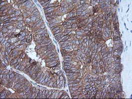 HRAS / H-Ras Antibody (clone OTI1D9)