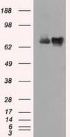 IHC-plus™ Heat Shock Protein 70 / HSPA1A Antibody (clone 5F3)