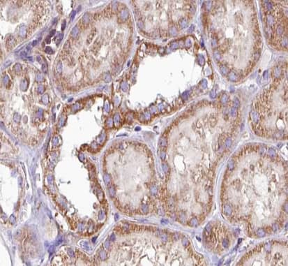 PRKCA / PKC-Alpha Antibody