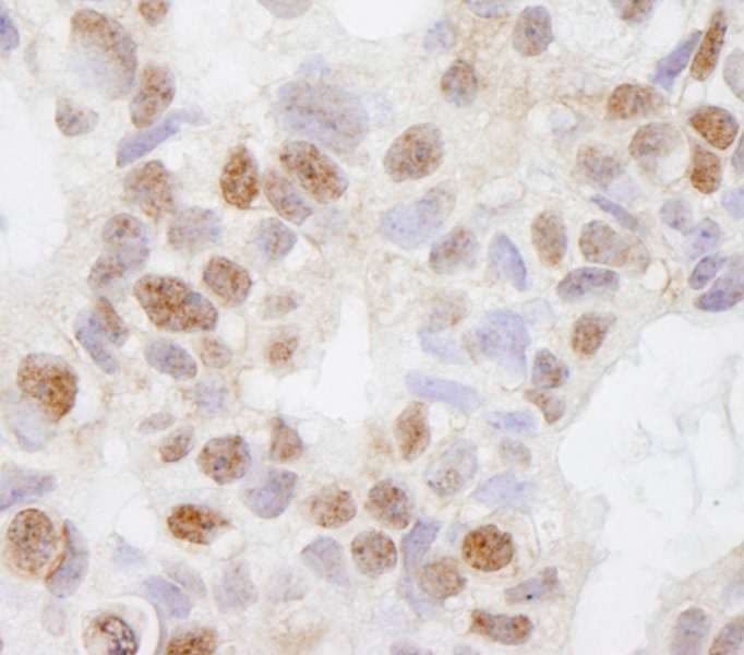 DHX38 Antibody (aa1150-1200)