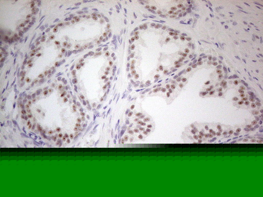 MALT1 Antibody (clone OTI3A2)