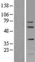 FIGNL1 Protein (Over-Expression Lysate Myc-DDK (Flag))