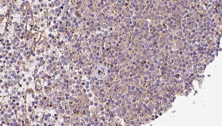 Cardiolipin Synthase / CRLS1 Antibody