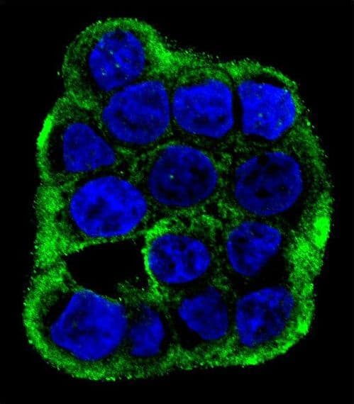CLC-7 / CLCN7 Antibody (aa692-720)