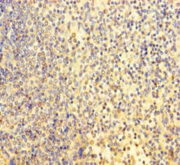 BRN2 / POU3F2 Antibody