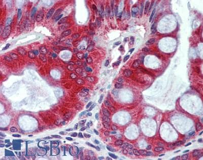 IHC-plus™ GUCA2A / Guanylin Antibody
