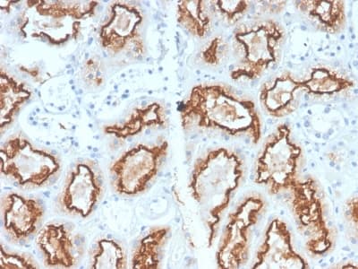 CA9 / Carbonic Anhydrase IX Antibody (clone CA9/2993R)