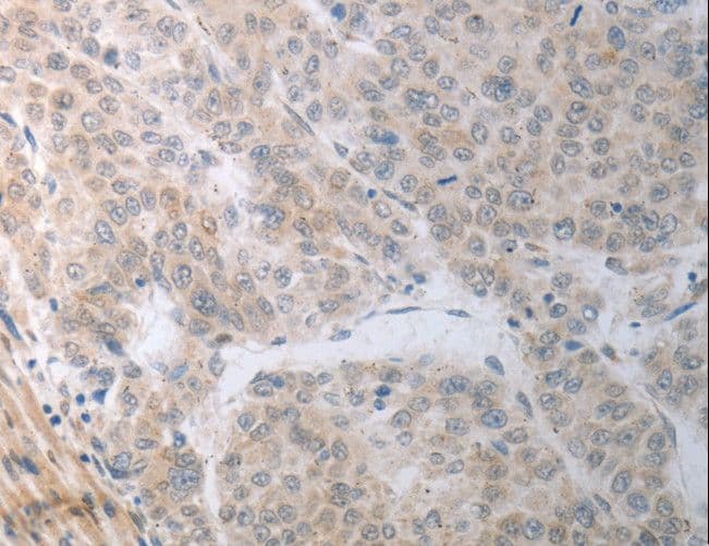 Polyclonal Rabbit anti-Human RBMS3 Antibody (IHC, WB)