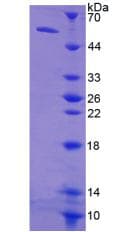 Human TK1 / TK / Thymidine Kinase Protein (Recombinant His-GST-S)