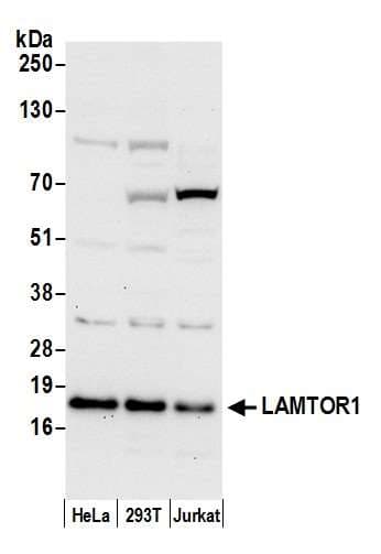 LAMTOR1 Antibody (aa111-161)