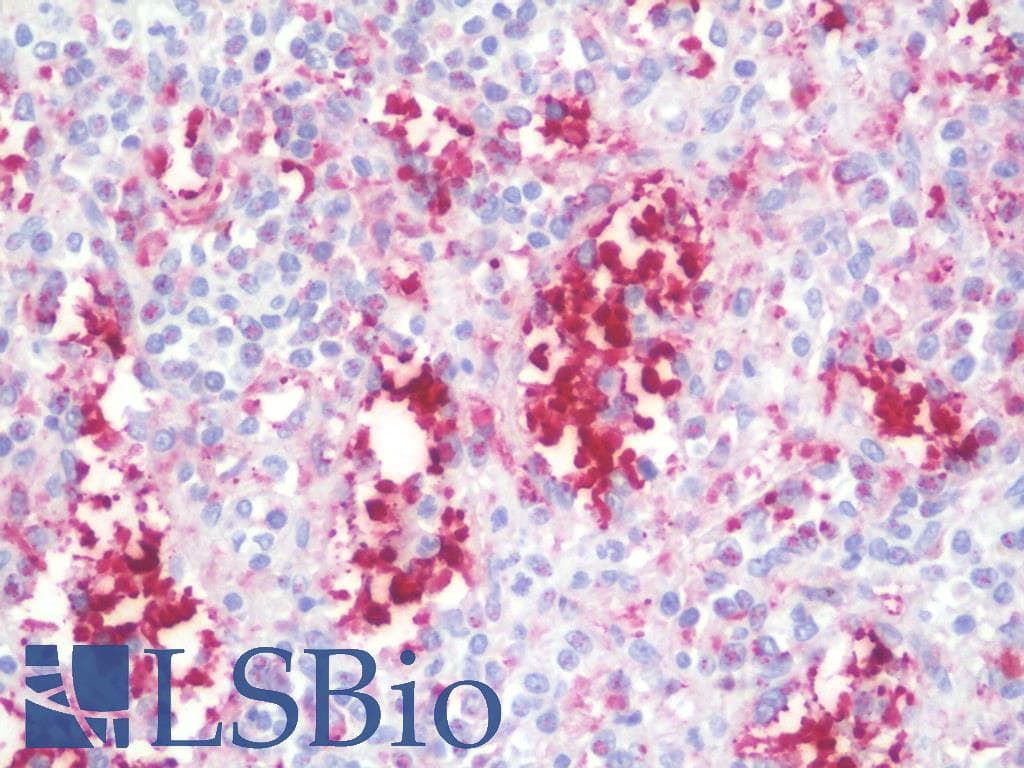 IHC-plus™ IL37 Antibody