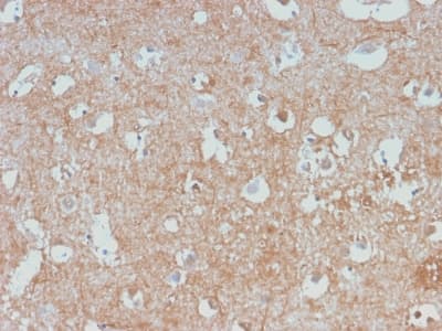 NF-L / NEFL Antibody (clone NEFL/2983R, Azide-free, Carrier-free)