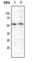 MEF2A / MEF2 Antibody