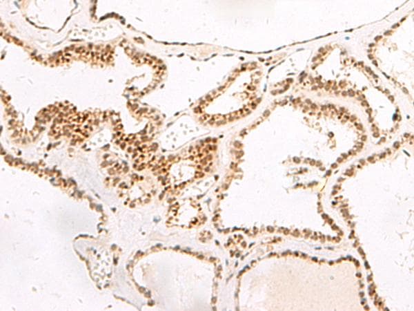 Polyclonal Rabbit anti-Human DGCR6L Antibody (IHC, WB)