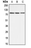 IHC-plus™ Polyclonal Rabbit anti-Human ABCB10 Antibody (Internal, IHC, IF, WB)