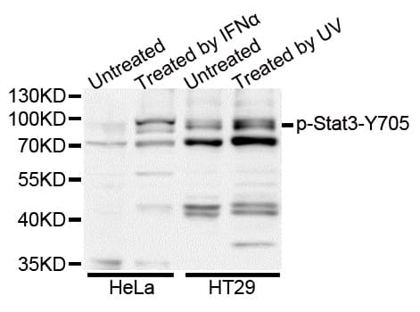 STAT3 Antibody (phospho-Tyr705)
