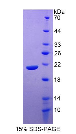 Human SLAMF7 / CRACC Protein (Recombinant His-S)