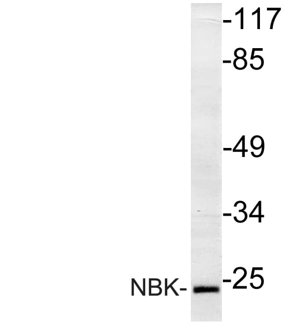 BIK Antibody (Met27)