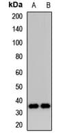 Polyclonal Rabbit anti-Human DIMT1L Antibody (WB)