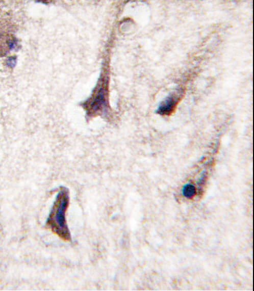 PRKCB / PKC-Beta Antibody (aa642-673)