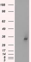 Monoclonal Mouse anti-Human LDHA / LDH1 Antibody (clone OTI2D11, IHC, WB)