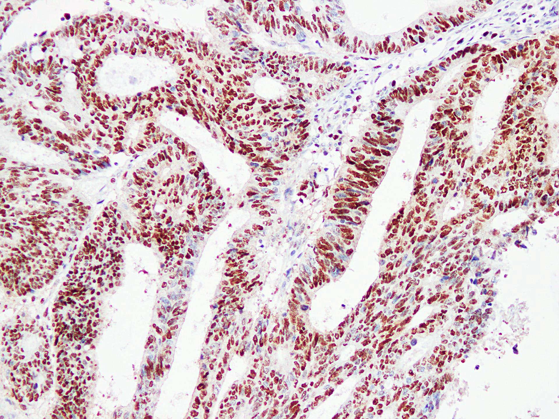 IHC-plus™ PCNA Antibody (clone ABT-PCNA)