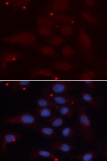 Polyclonal Rabbit anti-Human KPNA1 / Importin Alpha 5 Antibody (IHC, IF, WB)