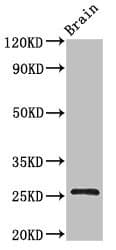 BTG4 Antibody