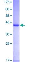 Human UBE2L6 Protein (Recombinant GST)