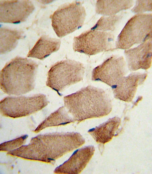 Polyclonal Rabbit anti-Human ARPC1A Antibody (aa286-315, IHC, IF, WB)