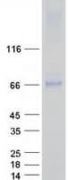 Human AOAH / Acyloxyacyl Hydrolase Protein (Recombinant Myc-DDK (Flag))