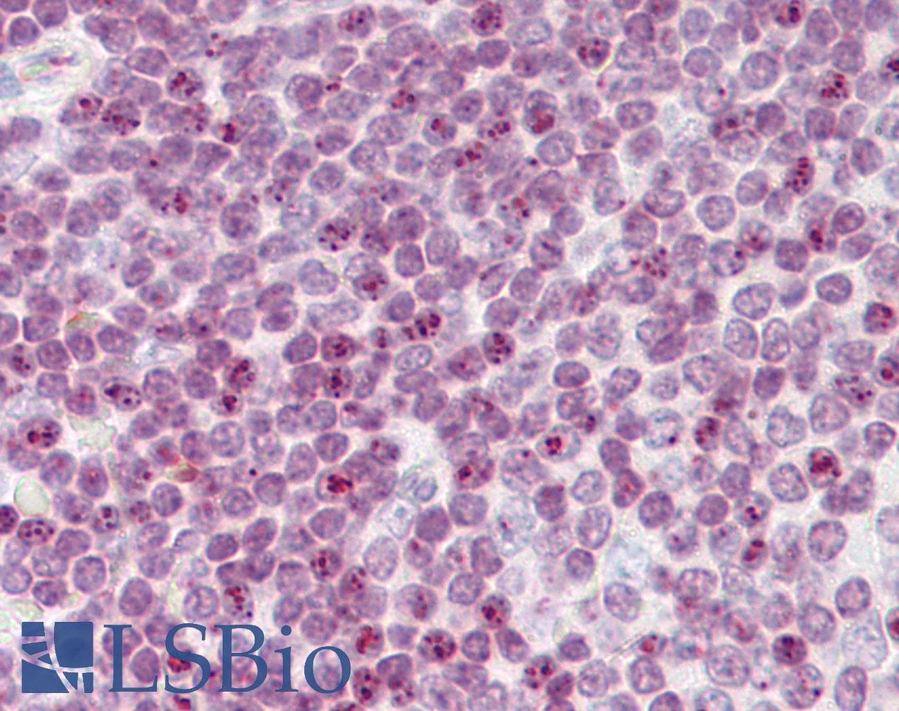 IHC-plus™ Polyclonal Rabbit anti-Human Histone H2A.X Antibody (aa50-100, IHC, WB)
