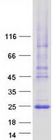 Human LHFPL3 Protein (Recombinant Myc-DDK (Flag))